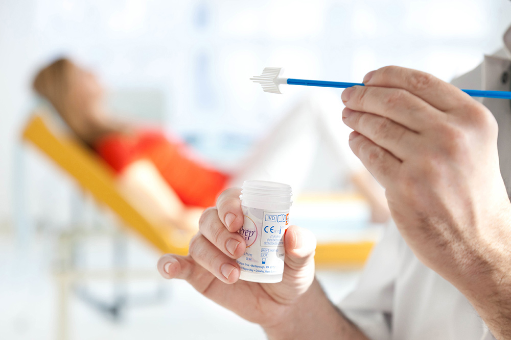 HPV Tanısı Nasıl Konur?