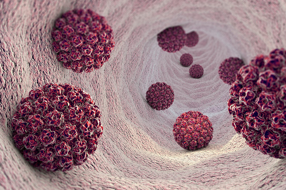 HPV ve Genital Siğil Nedir?